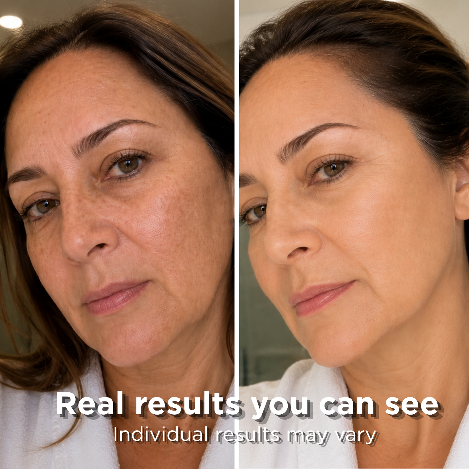 Ice face baby results cryoskincare
